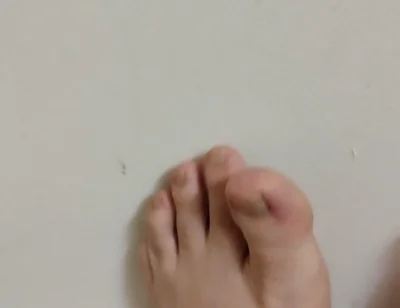 11-26-2025 Cute Little Toes