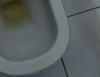 Homemade Method for Freezing the Penis