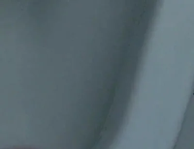 Homemade Method for Freezing the Penis.