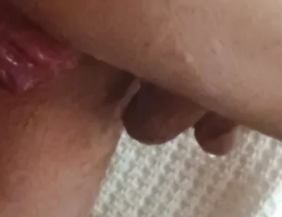 Prolapse and Urine