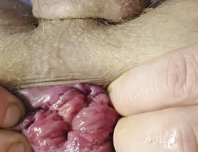 My Small Rose and Fingering Ass