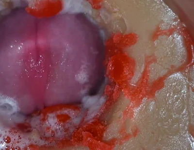 Insemination - Internal Camera Captures Deep Male Ejaculation