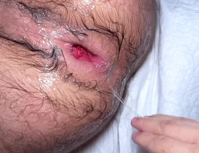 Masked Fister X Fisting Ffunantoni