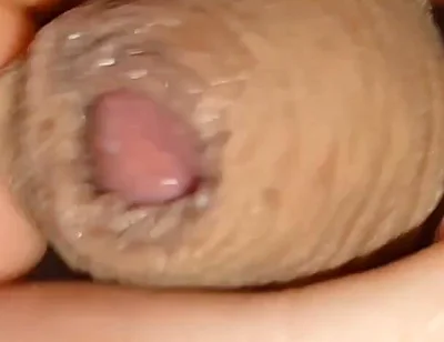 Cumshot of the Largest Phimosis Foreskin in the World.